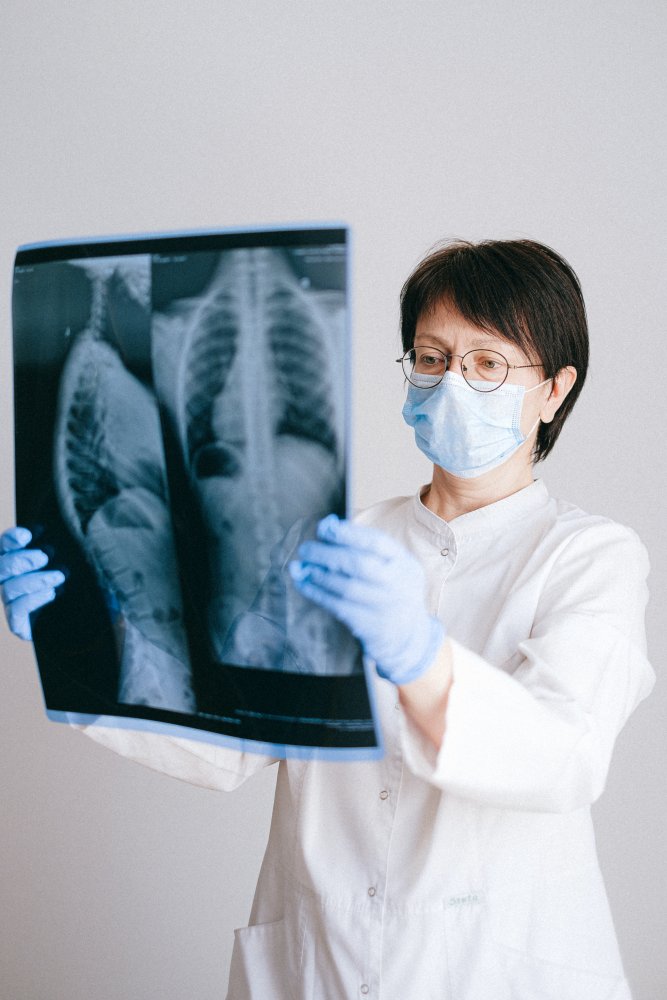 Lunge Röntgen Arzt