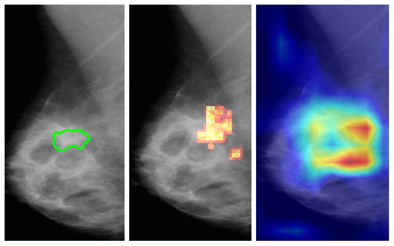 Visualiserungsmethode für die Ermittlung ausschlaggebender Bildbereiche eines KI-Modells: (a) Original mit annotiertem Befund, (b) Heat Map der Methode von vrvis , (c) Heat Map einer branchenüblichen Lösung (GradCAM).