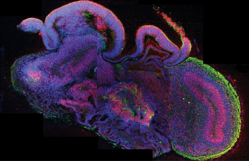 Querschnitt eines vollständigen zerebralen Organoids, der die Entwicklung von verschiedenen Gehirnregionen zeigt. Neurale Stammzellen sind in rot und Neuronen in grün hervorgehoben. 