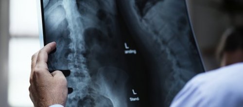 Arzt Röntgenbild