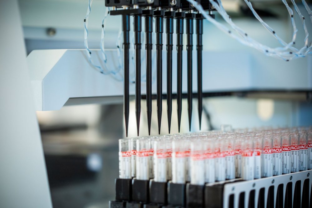 PCR Corona Test Alles Gurgelt Lifebrain Labor Röhrchen