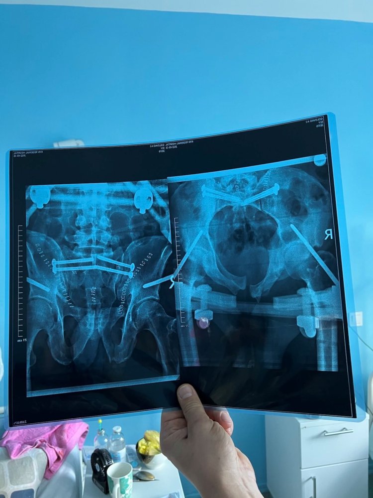 Röntgenbild Ukraine